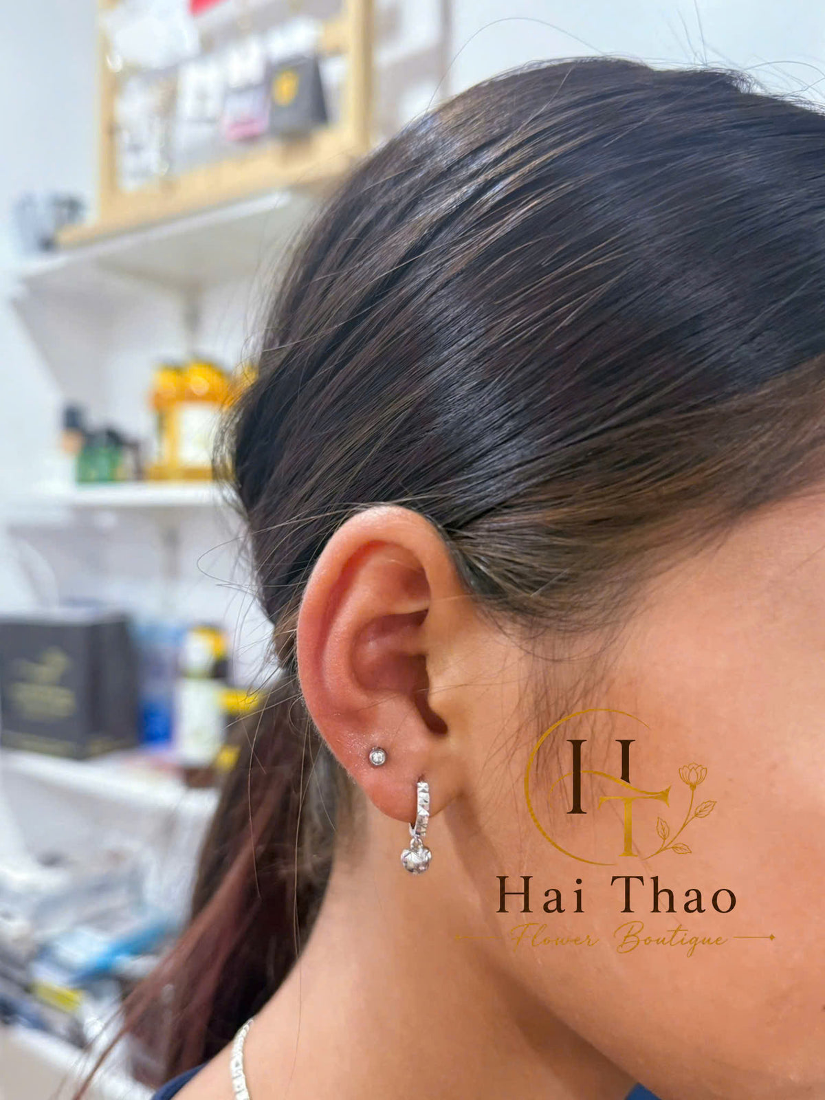 Upper lobe 2 bên tai cho bé 12 tuổi
