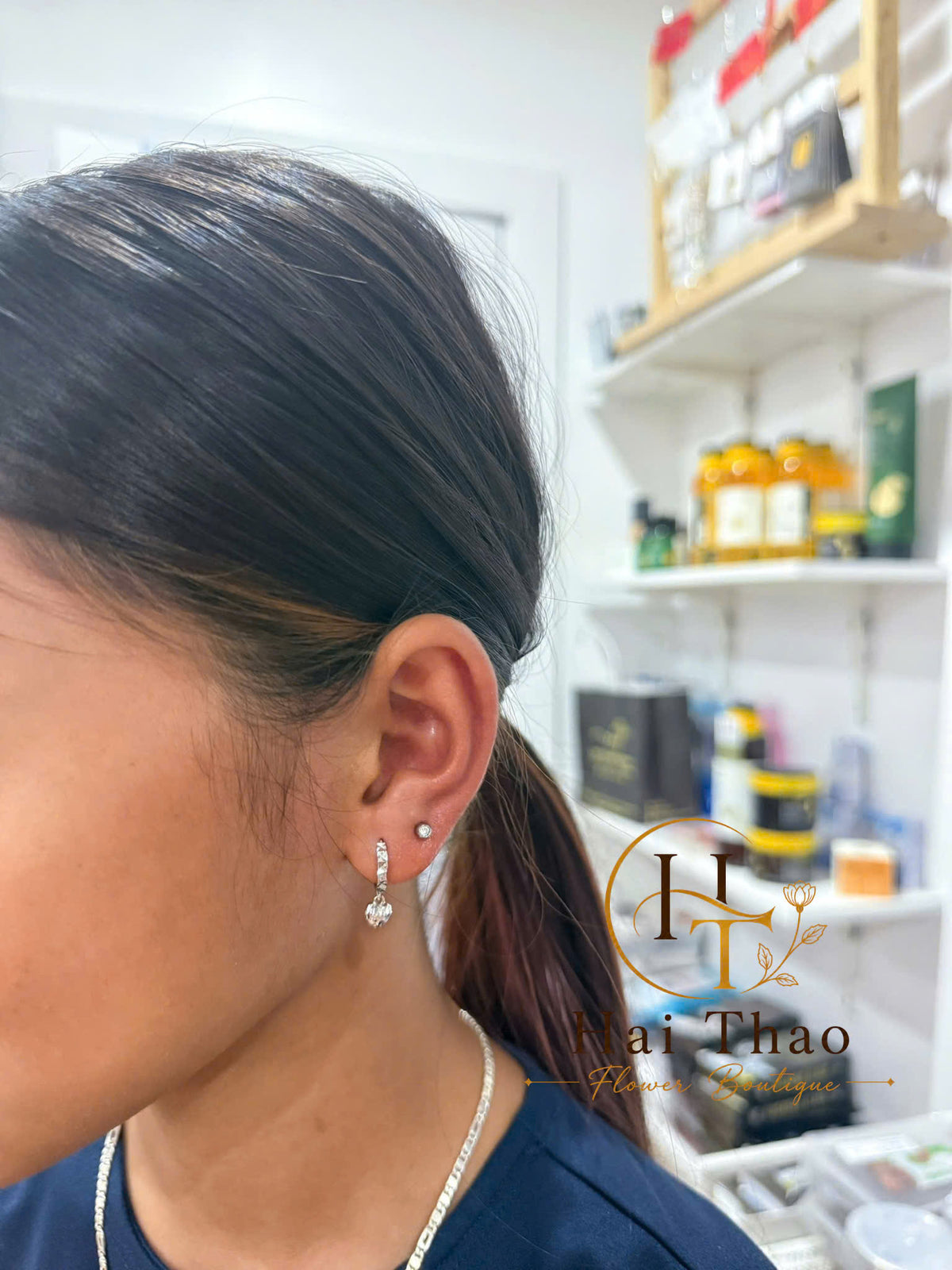 Upper lobe 2 bên tai cho bé 12 tuổi