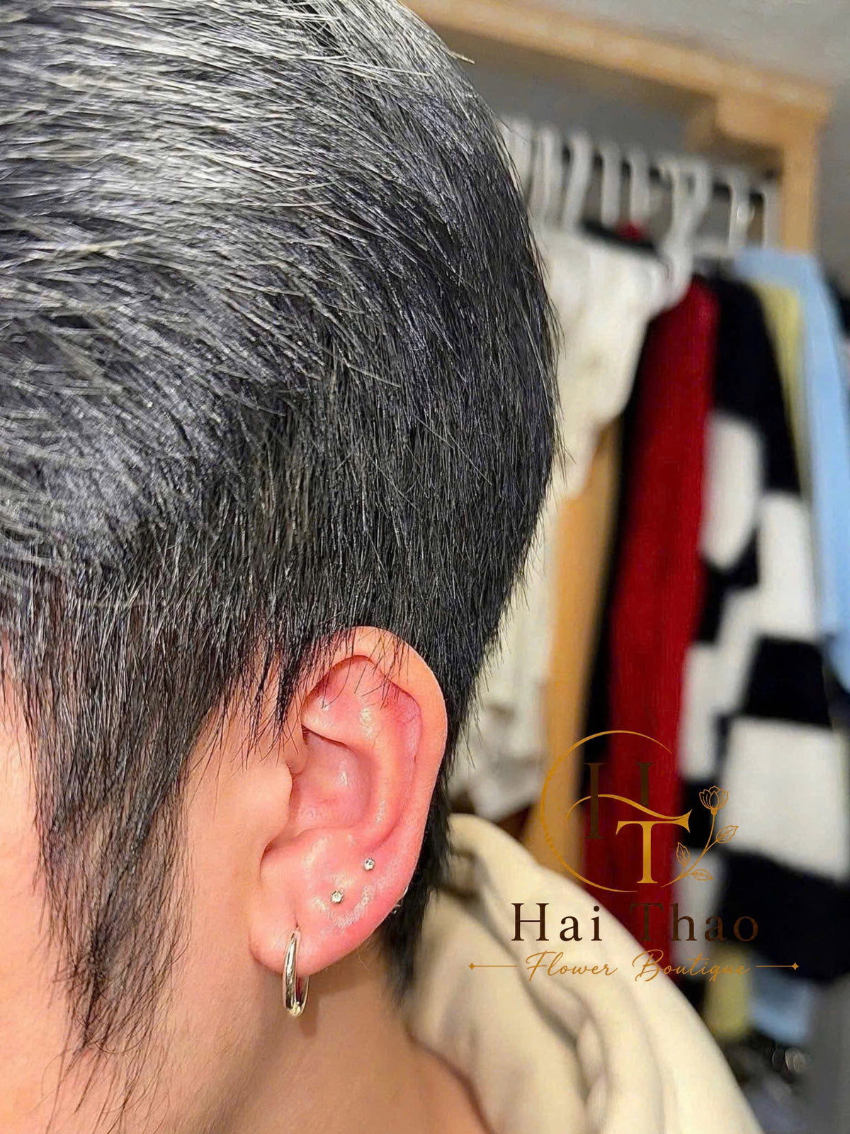 Bấm khuyên vị trí lobe mix uppber lobe