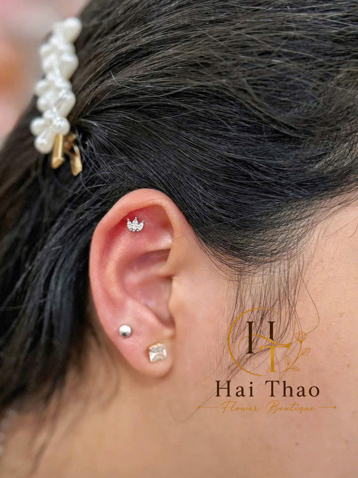 Bấm khuyên vị trí lobe mix uppber lobe