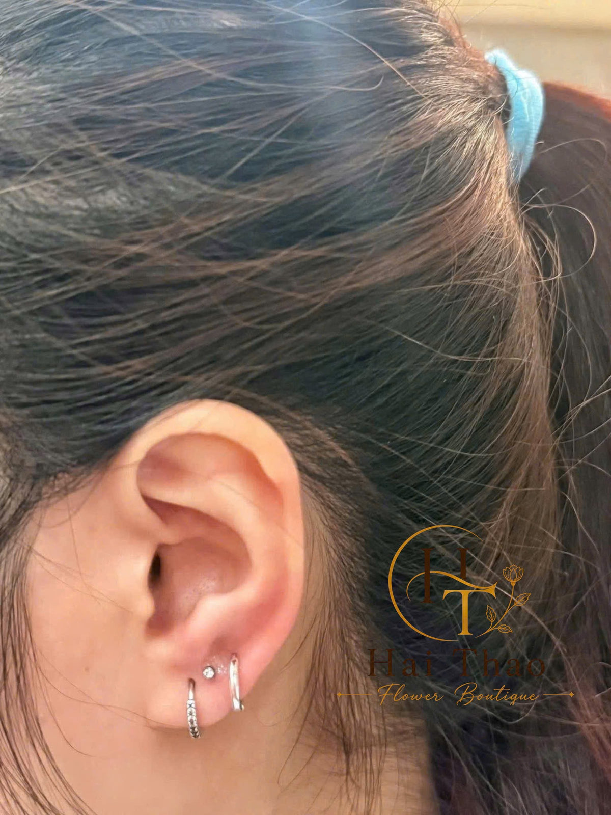 Bấm khuyên vị trí lobe mix uppber lobe