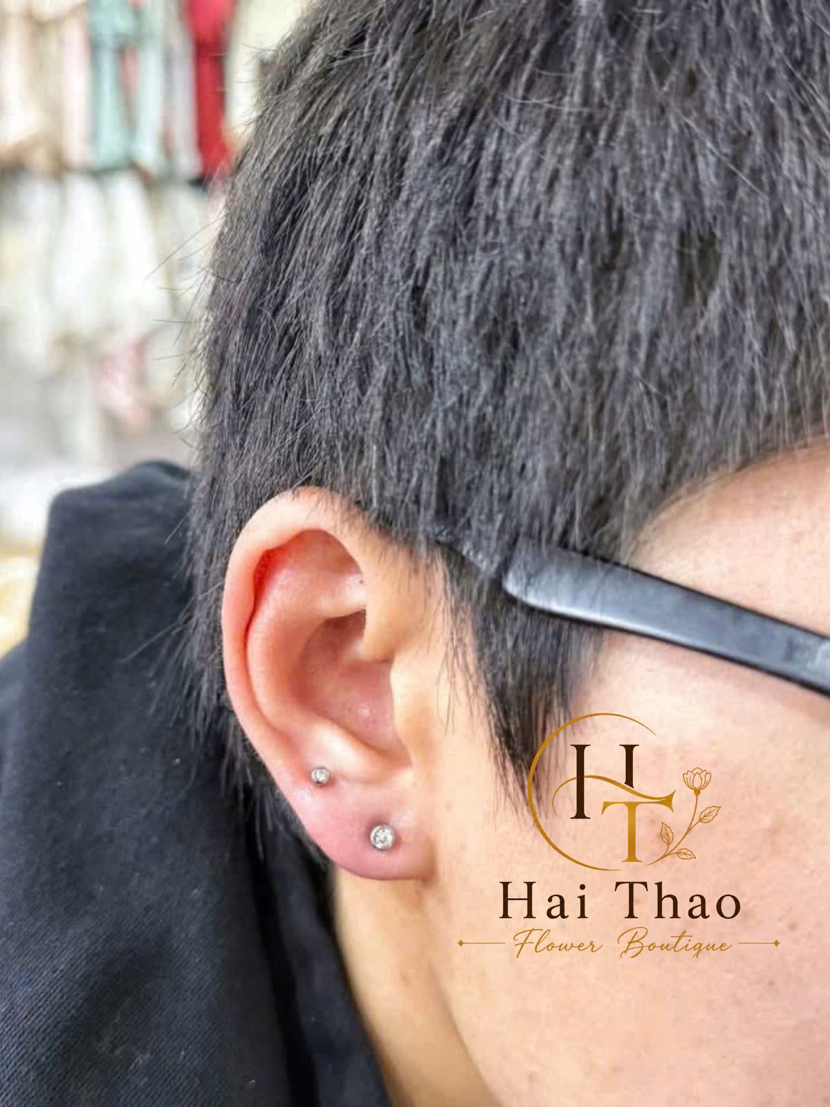 Bấm khuyên vị trí lobe mix uppber lobe