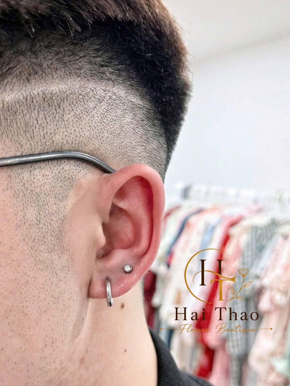 Bấm khuyên vị trí lobe mix uppber lobe