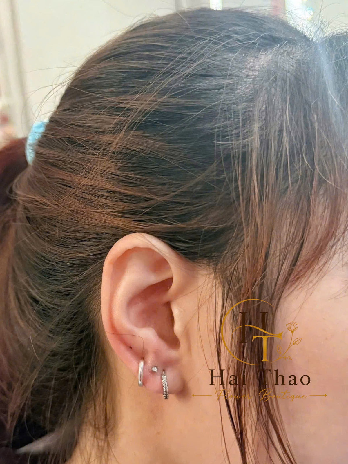Bấm khuyên vị trí lobe mix uppber lobe