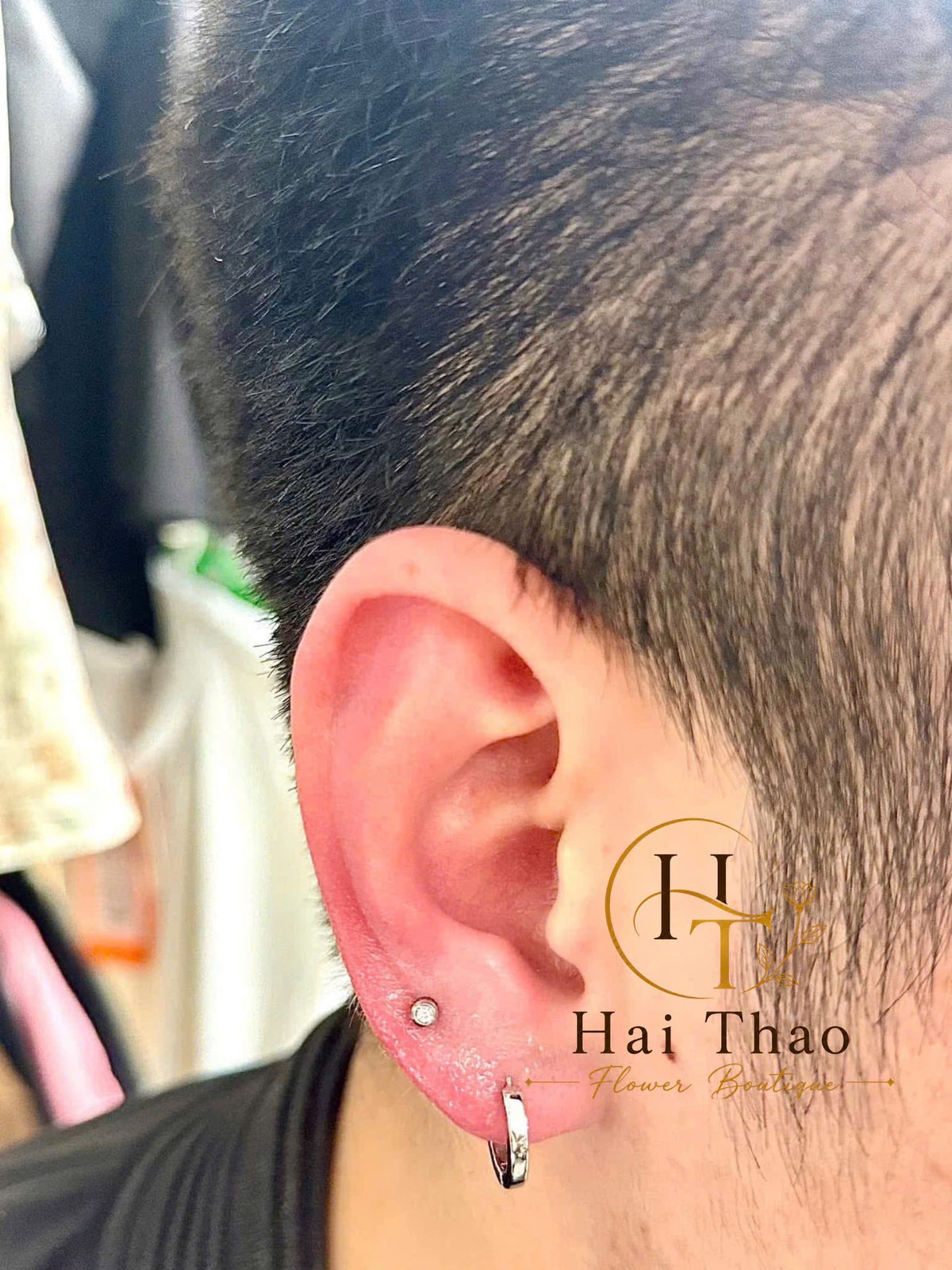Bấm khuyên vị trí lobe mix uppber lobe